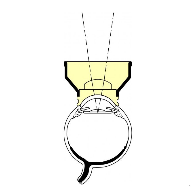 Lente Capsulotomia di Abraham