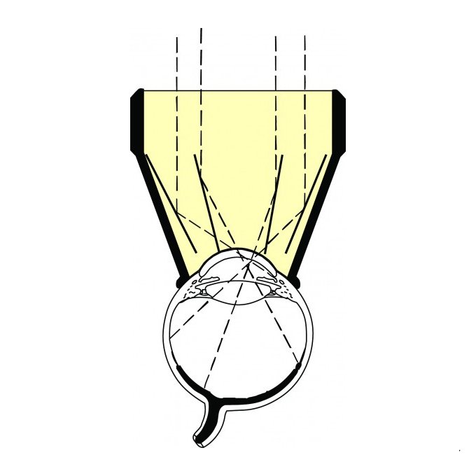 Lente laser di Karickhoff 4 specchi z.o. 18mm