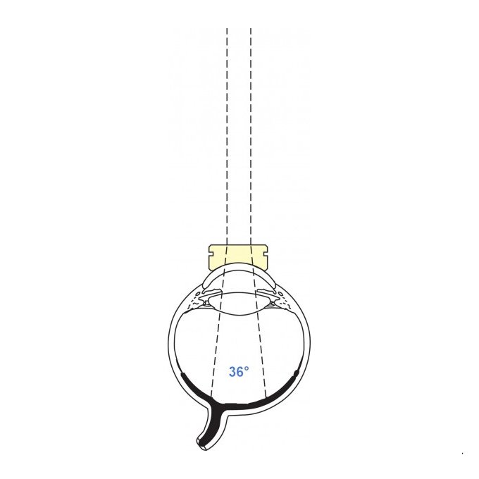 Lente pediatrica piatta Vitrectomia