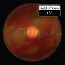 Lente Volk Fundus High Mag SSV Vitrectomia