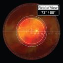 Lente Volk Central Retinal ACS Vitrectomia (copia)