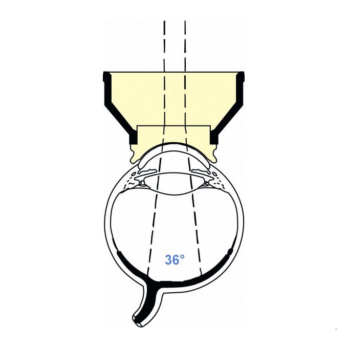 Lente laser per Fundus
