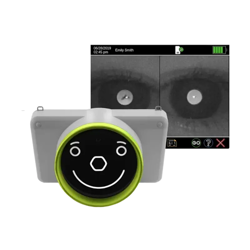 Autorefrattometro binoculare Plusoptix A20